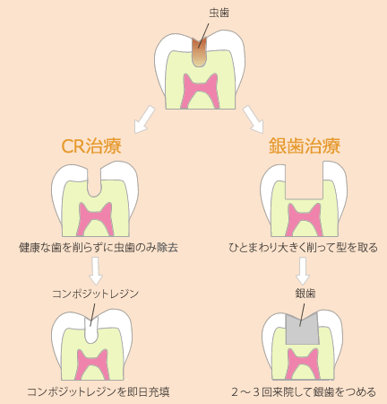 CR治療と従来の治療 image